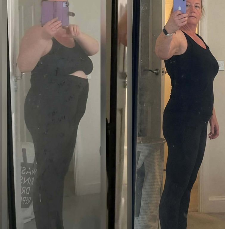 Before and after transformation 6